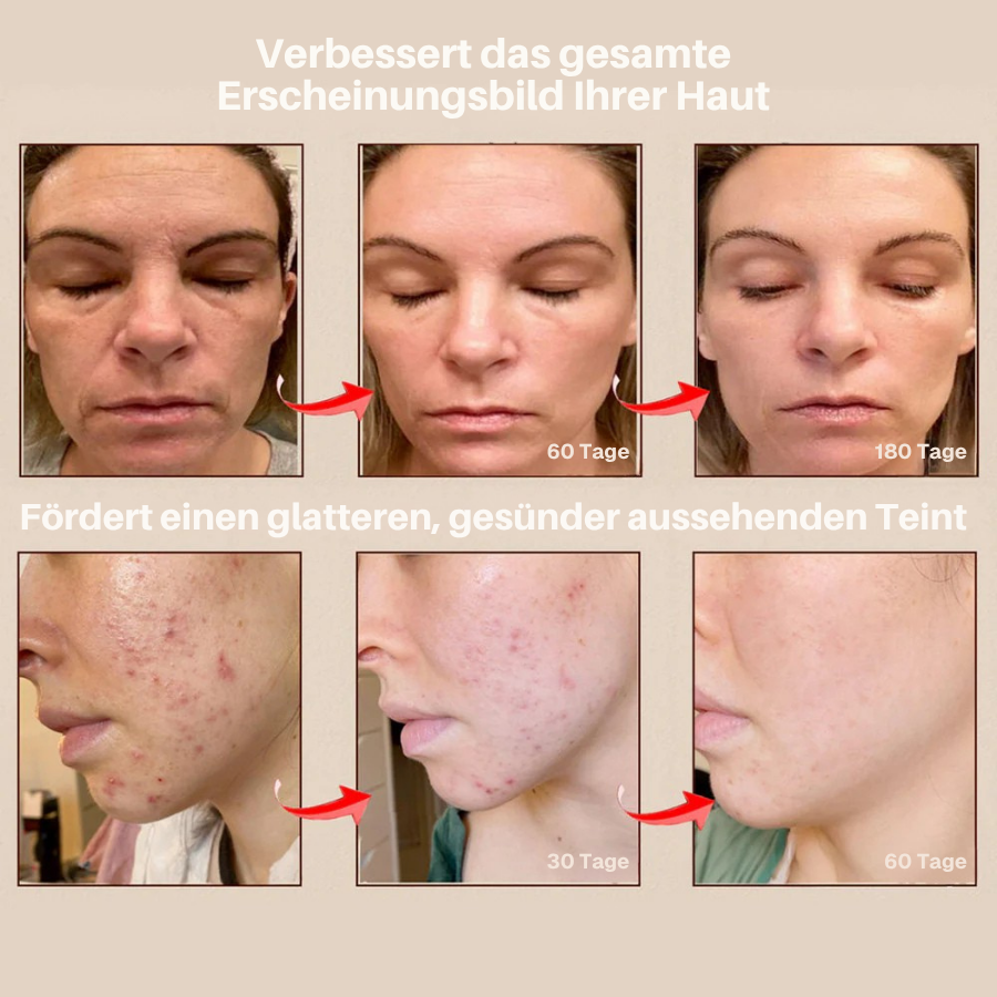 DERMALEA™ OPTO-RENEW Luxe