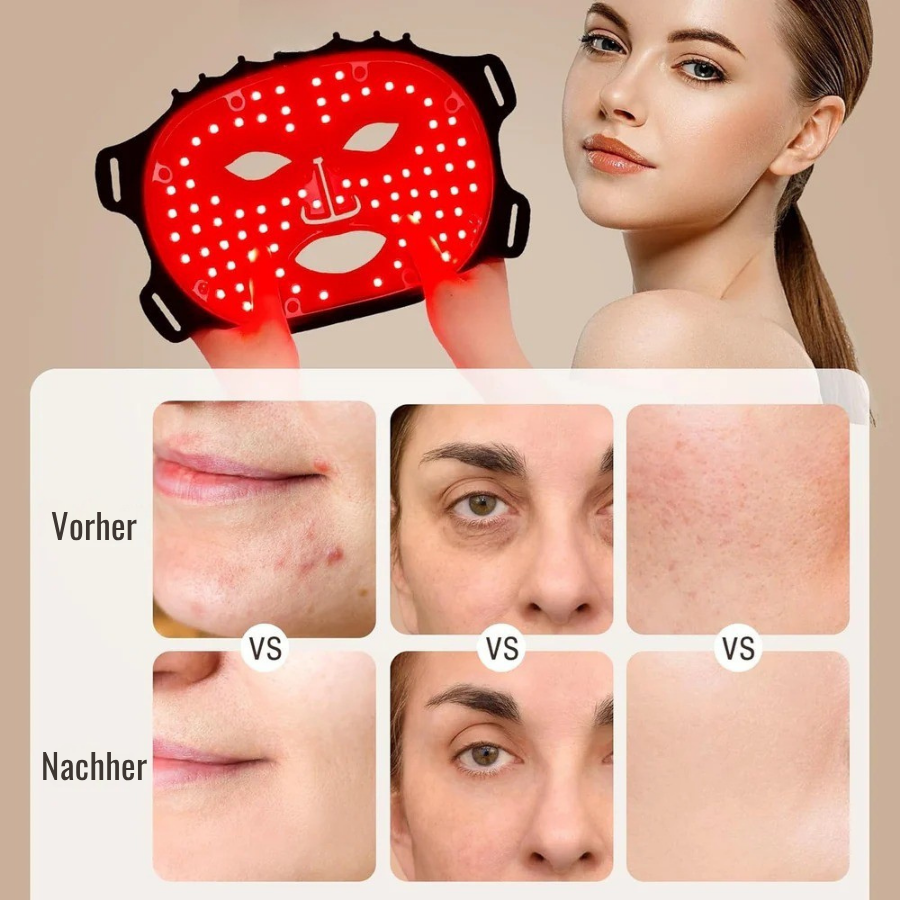 DERMALEA™ OPTO-RENEW Luxe