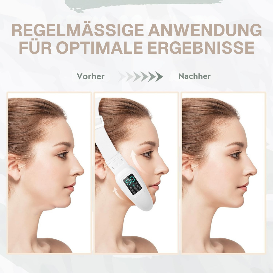 Intelligentes Gerät zur Gesichtsformung – 8 Modi zur Reduzierung des Doppelkinns und zur Definition der Kieferlinie