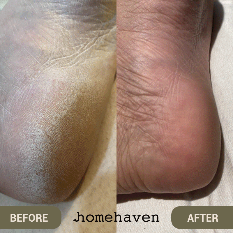 SpaSculpt Pro Pediküre & Hornhautentferner